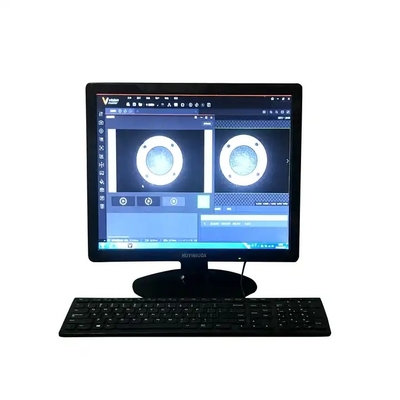 6MP Machine Vision  System Whole Inspection For Laboratory And Industry